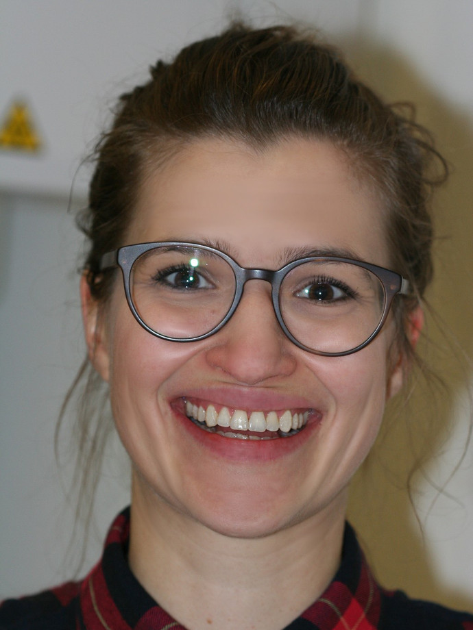 Anna 31 Jahre, Behandlung mit festsitzender Zahnspange (Saphirbrackets) nach parodontologischer Vorbehandlung, 1 Jahr 7 Monate