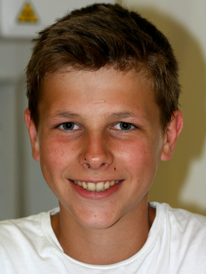 Martin, 15 Jahre, Behandlung mit festsitzender Zahnspange, 1 Jahr 7 Monate